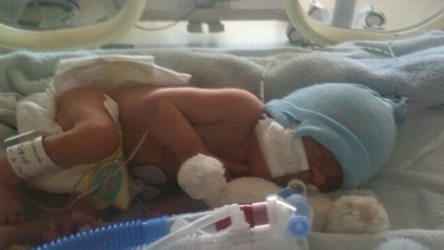 Guest post: World Premturity day picture of a premature baby in an incubator