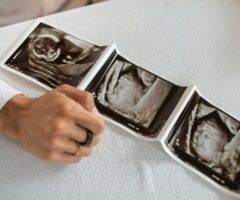 Handling the Pregnancy Curveballs That You Didn’t See Coming